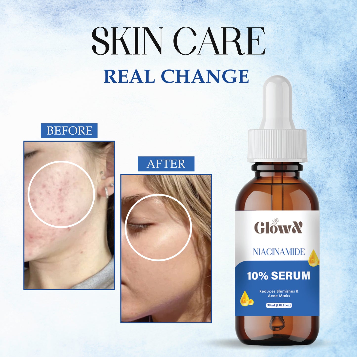 GlowX Niacinamide Face Serum For Clear Glowing Skin, Bright Skin, Reduces Dullness, Hydrates & Repairs Skin with Vit B3 & Hyaluronic Acid for Targets Acne Marks | For Women & Men | 30ml