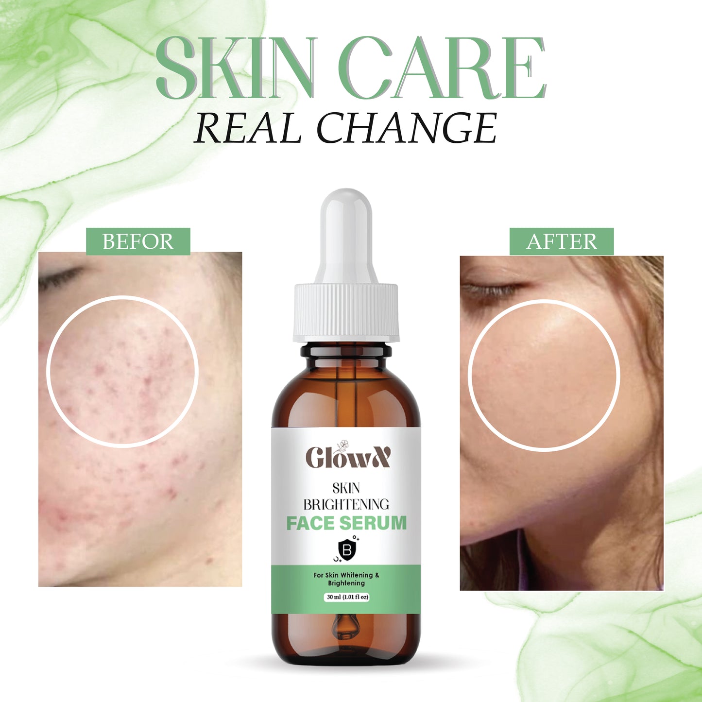 GlowX Skin Brightening Serum with 10% Niacinamide Serum with 0.3% Alpha Arbutin | Brightens skin, treats dullness, reduces tan | Lightweight, non-irritating & beginner-friendly formula|30ml