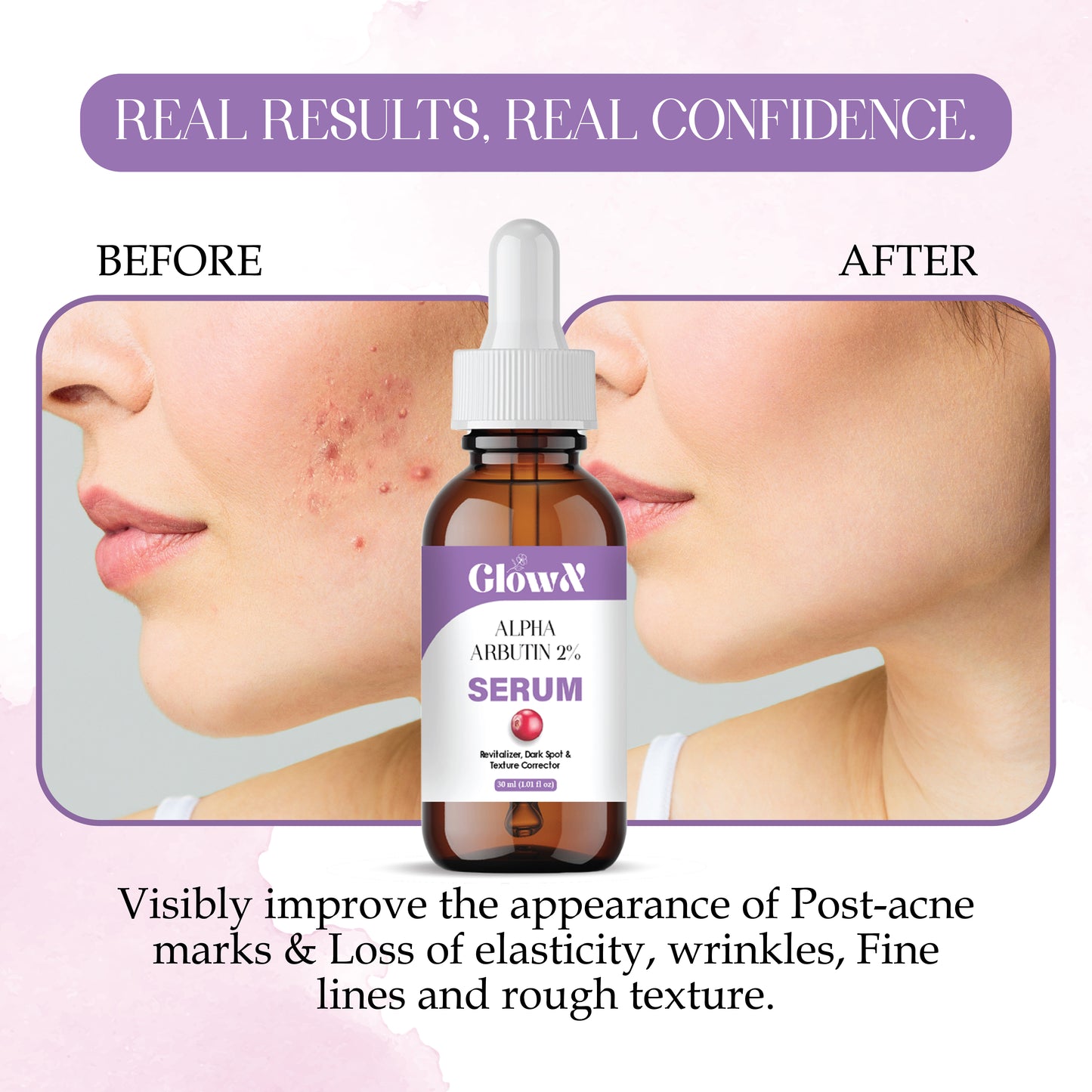 GlowX 5% Niacinamide Face Serum | + 2% Alpha Arbutin Face Serum | Clearing Serum for Pigmentation, Acne Marks, Dark Spots, Tanning | For Oily & Sensitive Skin | 30ml