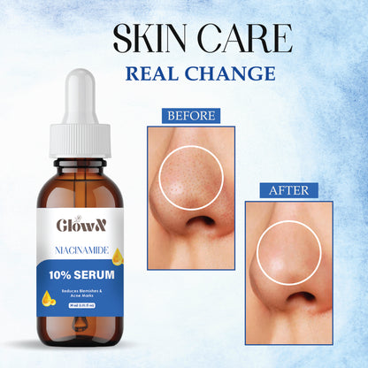 GlowX Niacinamide Face Serum For Clear Glowing Skin, Bright Skin, Reduces Dullness, Hydrates & Repairs Skin with Vit B3 & Hyaluronic Acid for Targets Acne Marks | For Women & Men | 30ml