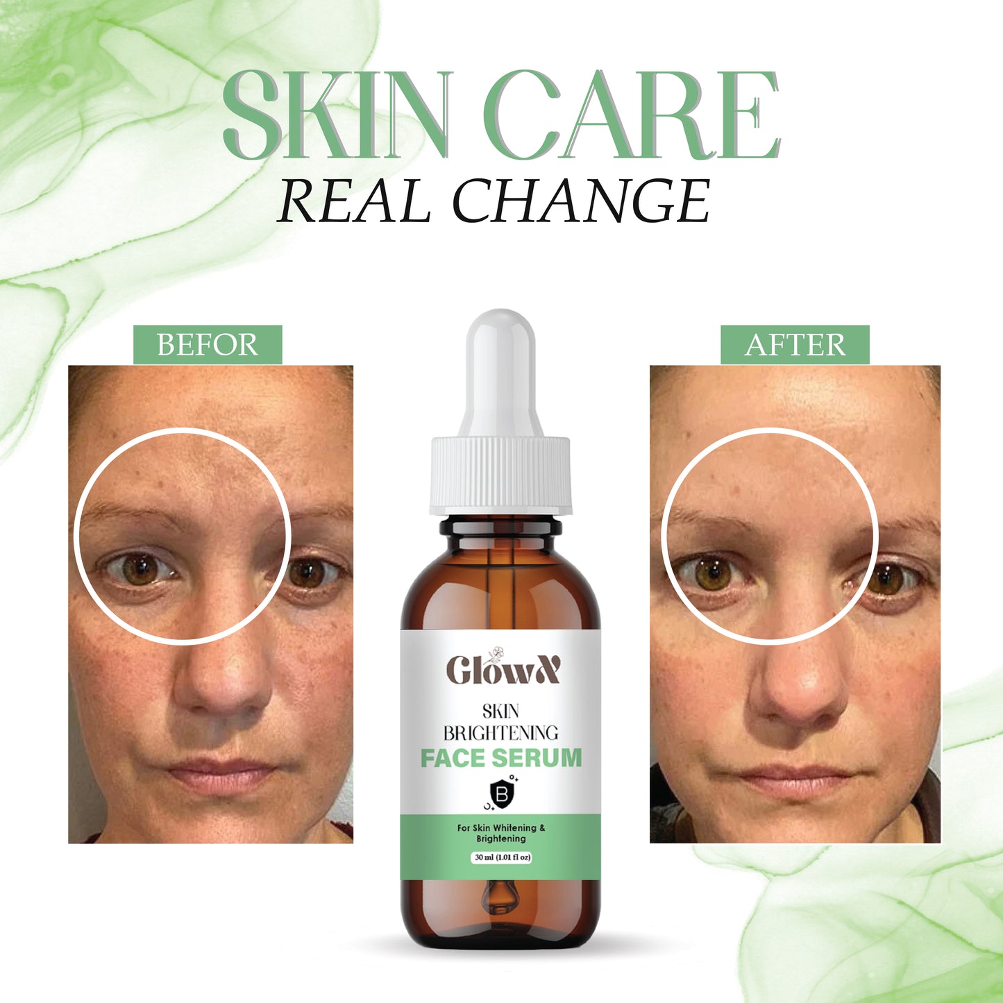 GlowX Skin Brightening Serum with 10% Niacinamide Serum with 0.3% Alpha Arbutin | Brightens skin, treats dullness, reduces tan | Lightweight, non-irritating & beginner-friendly formula|30ml