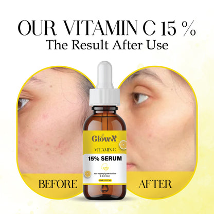 GlowX Vitamin C Serum 30ml for Glowing Skin|With 5% Niacinamide, Hyaluronic & Glycolic Acid|Fades Dark Spots, Pigmentation|For All, Oily, Combination, Normal Skin |Beginner Friendly - Men, Women